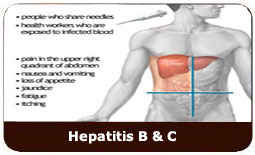Hepatitis B & C